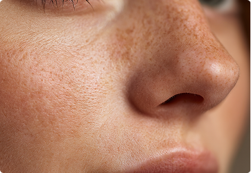 Zieht schnell ein, hinterlässt keinen klebrigen Film.