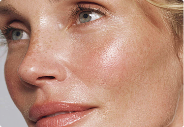 Spendet über Nacht Feuchtigkeit und unterstützt die Barrierefunktion (Glycerin, Polyglucuronsäure, Sheabutter, Jojobaöl).